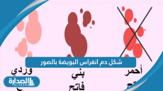 شكل دم انغراس البويضة بالصور