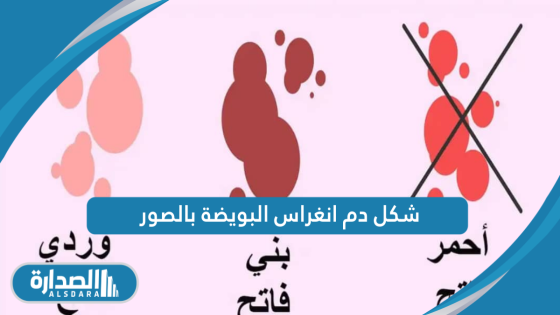 شكل دم انغراس البويضة بالصور